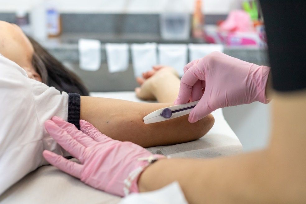 Acesso gratuito ao Implanon será oferecido pelo SUS neste fim de semana