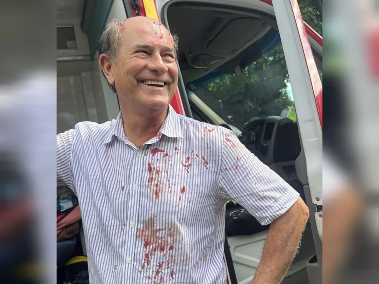 Mesmo ferido, piloto aparece sorrindo após pouso forçado em Goiás