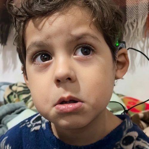 Menino de 3 anos ouve pela primeira vez após cirurgia de implante coclear